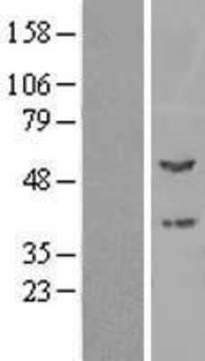 Western Blot: PPOX Overexpression Lysate (Adult Normal) [NBL1-14669] Left-Empty vector transfected control cell lysate (HEK293 cell lysate); Right -Over-expression Lysate for PPOX.