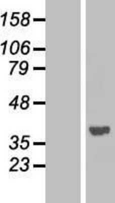 Western Blot: PPP1A Overexpression Lysate (Adult Normal) [NBP2-10998] Left-Empty vector transfected control cell lysate (HEK293 cell lysate); Right -Over-expression Lysate for PPP1A.