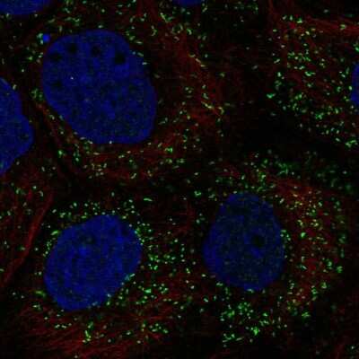 Immunocytochemistry/ Immunofluorescence PPP1R11 Antibody