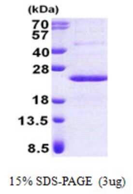 SDS-PAGE Recombinant Human PPP1R11 His Protein