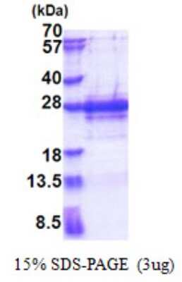 SDS-Page: Recombinant Human PP1 Inhibitor-2 Protein [NBP2-23380]