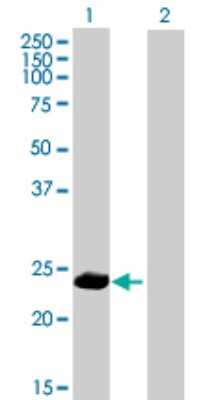 Western Blot: PPP1R2P9 Antibody [H00080316-B01P] - Analysis of PPP1R2P9 expression in transfected 293T cell line by PPP1R2P9 polyclonal antibody.  Lane 1: PPP1R2P9 transfected lysate(22.22 KDa). Lane 2: Non-transfected lysate.