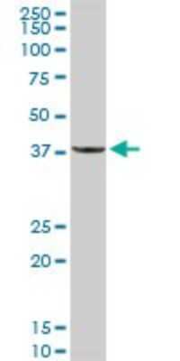 Western Blot: PPP1R3C Antibody [H00005507-D01P] - Analysis of PPP1R3C expression in human liver.