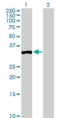 Western Blot: PPP1R3C Antibody [H00005507-D01P] - Analysis of PPP1R3C expression in transfected 293T cell line by PPP1R3C polyclonal antibody.Lane 1: PPP1R3C transfected lysate(36.40 KDa).Lane 2: Non-transfected lysate.