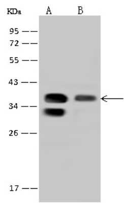 Western Blot: PPP1R3C Antibody [NBP2-97704] - Anti-PPP1R3C rabbit polyclonal antibody at 1:500 dilution. Lane A: Mouse kidney tissue lysate Lane B: U-251 MG Whole Cell Lysate Lysates/proteins at 30 ug per lane. Secondary Goat Anti-Rabbit IgG (H+L)/HRP at 1/10000 dilution. Developed using the ECL technique. Performed under reducing conditions. Predicted band size: 37 kDa. Observed band size: 37 kDa