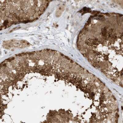 Immunohistochemistry: PPP1R7 Antibody [NBP2-38207] - Staining of human testis shows strong cytoplasmic and nuclear positivity in cells in seminiferus ducts.