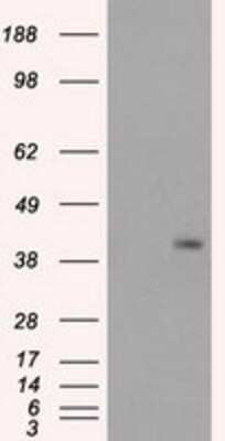 Western Blot: PPP1R7 Antibody (OTI4F9) - Azide and BSA Free [NBP2-73586] - HEK293T cells were transfected with the pCMV6-ENTRY control (Left lane) or pCMV6-ENTRY PPP1R7 (Right lane) cDNA for 48 hrs and lysed. Equivalent amounts of cell lysates (5 ug per lane) were separated by SDS-PAGE and immunoblotted with anti-PPP1R7.