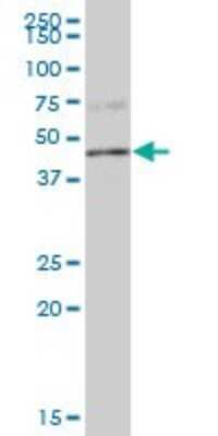 Western Blot: PPP1R7 Antibody [H00005510-B01P] - Analysis of PPP1R7 expression in human spleen.