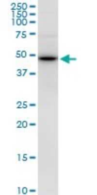 Western Blot: PPP1R7 Antibody [H00005510-B02P] - Analysis of PPP1R7 expression in Jurkat.