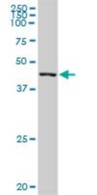 Western Blot: PPP1R7 Antibody [H00005510-B02P] - Analysis of PPP1R7 expression in human spleen.