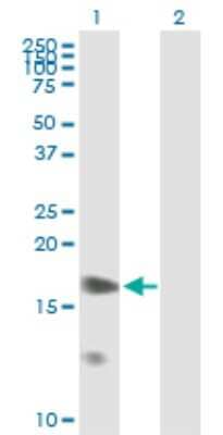 Western Blot: PPP1R7 Antibody [H00005510-B02P] - Analysis of PPP1R7 expression in transfected 293T cell line by PPP1R7 polyclonal antibody.  Lane 1: PPP1R7 transfected lysate(39.71 KDa). Lane 2: Non-transfected lysate.