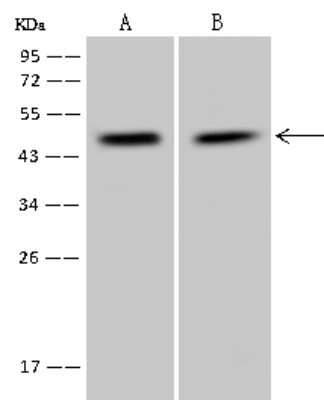 Western Blot: PPP1R7 Antibody [NBP2-97835] - Anti-PPP1R7 rabbit polyclonal antibody at 1:500 dilution. Lane A: RT-4 Whole Cell Lysate Lane B: U-251 MG Whole Cell Lysate Lysates/proteins at 30 ug per lane. Secondary Goat Anti-Rabbit IgG (H+L)/HRP at 1/10000 dilution. Developed using the ECL technique. Performed under reducing conditions. Predicted band size: 42 kDa. Observed band size: 45 kDa