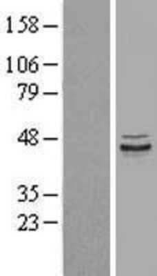 Western Blot PPP1R7 Overexpression Lysate