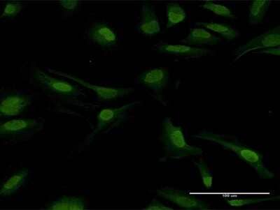 Immunocytochemistry/Immunofluorescence: PPP2CB Antibody [H00005516-B01P] - Analysis of purified antibody to PPP2CB on HeLa cell. (antibody concentration 10 ug/ml)