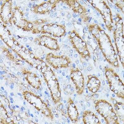 Immunohistochemistry-Paraffin: PPP2CB Antibody [NBP2-94074] - Paraffin-embedded rat kidney using PPP2CB .