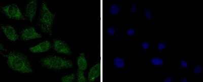 Immunocytochemistry/Immunofluorescence: PPP2CB Antibody (SN70-08) [NBP2-67688] - Staining PP2A alpha + beta in L6 cells (green). The nuclear counter stain is DAPI (blue). Cells were fixed in paraformaldehyde, permeabilised with 0.25% Triton X100/PBS.