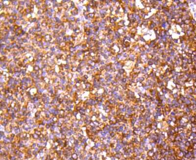 Immunohistochemistry-Paraffin: PPP2CB Antibody (SN70-08) [NBP2-67688] - Analysis of paraffin-embedded human tonsil tissue using anti-PP2A alpha + beta antibody. Counter stained with hematoxylin.