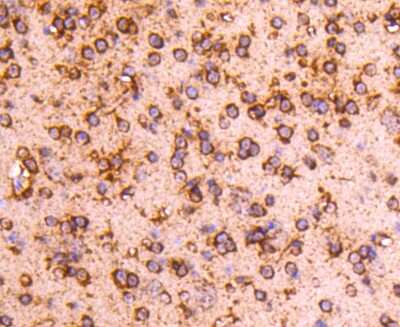 Immunohistochemistry-Paraffin: PPP2CB Antibody (SN70-08) [NBP2-67688] - Analysis of paraffin-embedded mouse brain tissue using anti-PP2A alpha + beta antibody. Counter stained with hematoxylin.