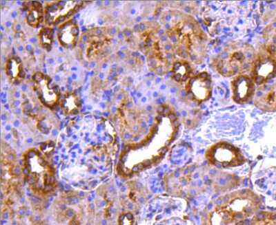 Immunohistochemistry-Paraffin: PPP2CB Antibody (SN70-08) [NBP2-67688] - Analysis of paraffin-embedded rat kidney tissue using anti-PP2A alpha + beta antibody. Counter stained with hematoxylin.