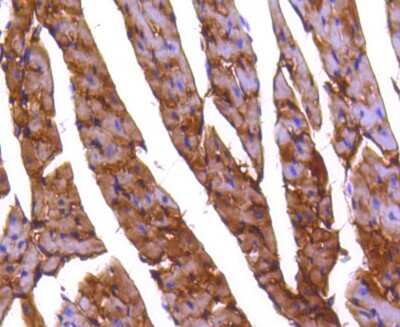 Immunohistochemistry-Paraffin: PPP2CB Antibody (SN70-08) [NBP2-67688] - Immunohistochemical analysis of paraffin-embedded mouse heart tissue using anti-PPP2CB antibody. The section was pre-treated using heat mediated antigen retrieval with Tris-EDTA buffer (pH 8.0-8.4) for 20 minutes. The tissues were blocked in 5% BSA for 30 minutes at room temperature, washed with ddH2O and PBS, and then probed with the primary antibody (1/50) for 30 minutes at room temperature. The detection was performed using an HRP conjugated compact polymer system. DAB was used as the chromogen. Tissues were counterstained with hematoxylin and mounted with DPX.