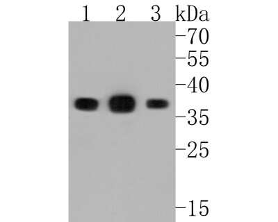 Western Blot: PPP2CB Antibody (SN70-08) [NBP2-67688] - Western blot analysis of PPP2CB on different lysates. Proteins were transferred to a PVDF membrane and blocked with 5% BSA in PBS for 1 hour at room temperature. The primary antibody (1/500) was used in 5% BSA at room temperature for 2 hours. Goat Anti-Ra
