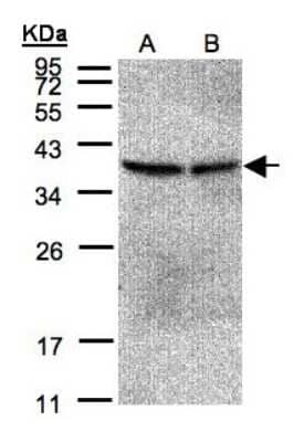 Western Blot: PPP2CB Antibody [NBP1-32069] - Sample(30 ug of whole cell lysate) A:293T B:A431 12% SDS PAGE, antibody diluted at 1:500.