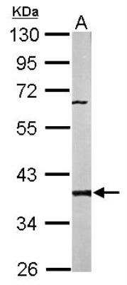 Western Blot: PPP2CB Antibody [NBP1-32069] - Sample (50 ug of whole cell lysate) A: Mouse brain 10% SDS PAGE; antibody diluted at 1:1000.