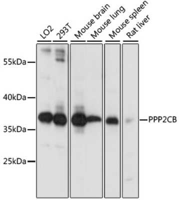 Western Blot: PPP2CB Antibody [NBP2-94074] - Analysis of extracts of various cell lines, using PPP2CB at 1:1000 dilution. Secondary antibody: HRP Goat Anti-Rabbit IgG (H+L) at 1:10000 dilution. Lysates/proteins: 25ug per lane. Blocking buffer: 3% nonfat dry milk in TBST. Detection: ECL Basic Kit . Exposure time: 30s.