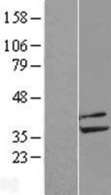 Western Blot: PPP2CB Overexpression Lysate (Adult Normal) [NBL1-14690] Left-Empty vector transfected control cell lysate (HEK293 cell lysate); Right -Over-expression Lysate for PPP2CB.