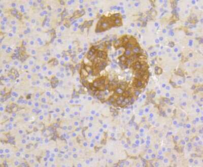 Immunohistochemistry-Paraffin: PPP2CB [p Tyr307] Antibody (ST49-05) [NBP2-67512] - Analysis of paraffin-embedded human pancreas tissue using anti-Phospho-PP2A(pY307) antibody. Counter stained with hematoxylin.