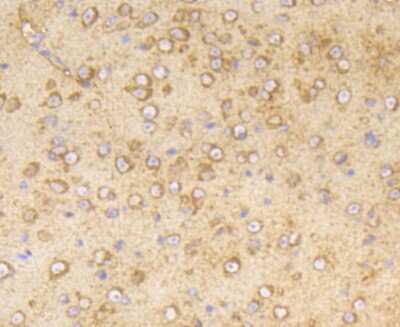 Immunohistochemistry-Paraffin: PPP2CB [p Tyr307] Antibody (ST49-05) [NBP2-67512] - Analysis of paraffin-embedded mouse brain tissue using anti-Phospho-PP2A(pY307) antibody. Counter stained with hematoxylin.