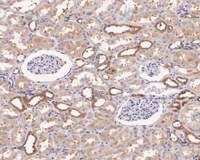 Immunohistochemistry-Paraffin: PPP2CB [p Tyr307] Antibody (ST49-05) [NBP2-67512] - Analysis of paraffin-embedded human kidney tissue with Rabbit anti-Phospho-PP2A(Y307) antibody washed with ddH2O and PBS, and then probed with the primary antibody  at 1/200 dilution for 1 hour at room temperature. The detection was performed using an HRP conjugated compact polymer system. DAB was used as the chromogen. Tissues were counterstained with hematoxylin and mounted with DPX.