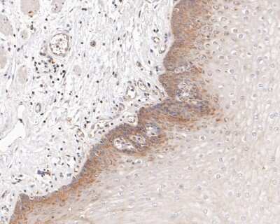 Immunohistochemistry-Paraffin: PPP2CB [p Tyr307] Antibody (ST49-05) [NBP2-67512] - Analysis of paraffin-embedded human esophagus tissue with Rabbit anti-PPP2CB [p Tyr307] antibody washed with ddH2O and PBS, and then probed with the primary antibody  at 1/200 dilution for 1 hour at room temperature. The detection was performed using an HRP conjugated compact polymer system. DAB was used as the chromogen. Tissues were counterstained with hematoxylin and mounted with DPX.