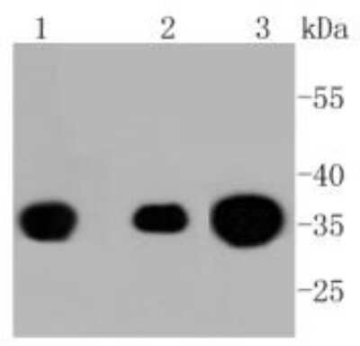 Western Blot: PPP2CB [p Tyr307] Antibody (ST49-05) [NBP2-67512] - Analysis of Phospho-PP2A(pY307) on different lysates using anti-Phospho-PP2A(pY307) antibody at 1/1,000 dilution. Positive control: Lane 1: A431 Lane 2: F9 Lane 3: PC12