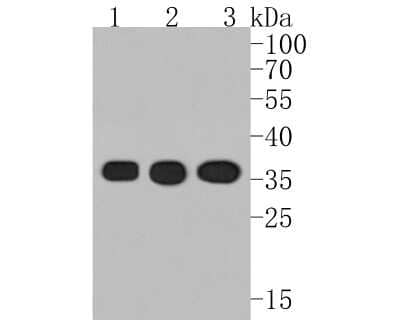 Western Blot: PPP2CB [p Tyr307] Antibody (ST49-05) [NBP2-67512] - Analysis of PPP2CB [p Tyr307] on different lysates. Proteins were transferred to a PVDF membrane and blocked with 5% BSA in PBS for 1 hour at room temperature. The primary antibody (1/500) was used in 5% BSA at room temperature for 2 hours. Goat Anti-Rabbit IgG - HRP Secondary Antibody at 1:5,000 dilution was used for 1 hour at room temperature.Positive control: Lane 1: F9 cell lysateLane 2: PC-12 cell lysateLane 3: A431 cell lysate