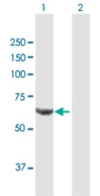 Western Blot: PPP2R1B Antibody [H00005519-B01P] - Analysis of PPP2R1B expression in transfected 293T cell line by PPP2R1B polyclonal antibody.  Lane 1: PPP2R1B transfected lysate(66.11 KDa). Lane 2: Non-transfected lysate.