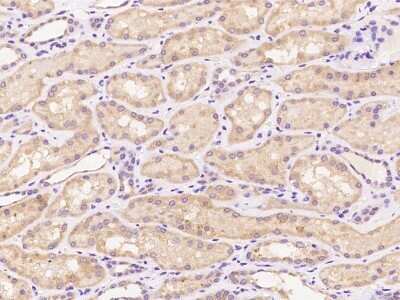 Immunohistochemistry: PPP2R2A Antibody [NBP3-06295] - Immunochemical staining of human PPP2R2A in human kidney with rabbit polyclonal antibody at 1:100 dilution, formalin-fixed paraffin embedded sections.