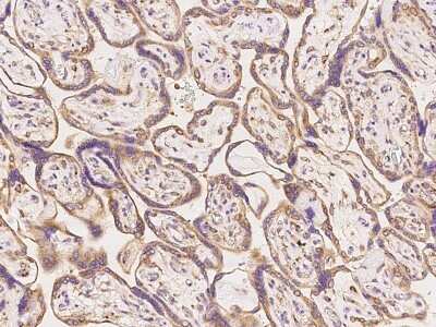 Immunohistochemistry: PPP2R2A Antibody [NBP3-06295] - Immunochemical staining of human PPP2R2A in human placenta with rabbit polyclonal antibody at 1:100 dilution, formalin-fixed paraffin embedded sections.