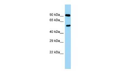 Western Blot: PPP2R2A Antibody [NBP3-09343] - Western blot analysis of PPP2R2A in Rat Testis lysates. Antibody dilution at 1.0ug/ml