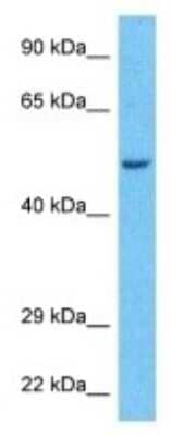 Western Blot: PPP2R2A Antibody [NBP3-09947] - Western blot analysis of PPP2R2A in Hela Whole Cell lysates. Antibody dilution at 1.0ug/ml