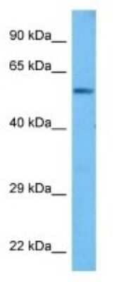 Western Blot: PPP2R2A Antibody [NBP3-11005] - Western blot analysis of PPP2R2A in Mouse Skeletal Muscle lysates. Antibody dilution at 1ug/ml