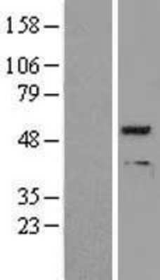 Western Blot: PPP2R2A Overexpression Lysate (Adult Normal) [NBL1-14694] Left-Empty vector transfected control cell lysate (HEK293 cell lysate); Right -Over-expression Lysate for PPP2R2A.