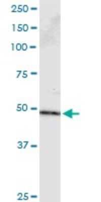 Immunoprecipitation: PPP2R2B Antibody (1B10) [H00005521-M23] - Analysis of PPP2R2B transfected lysate using anti-PPP2R2B monoclonal antibody and Protein A Magnetic Bead, and immunoblotted with PPP2R2B rabbit polyclonal antibody.