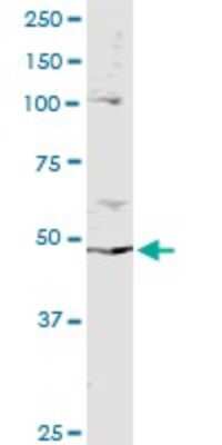 Immunoprecipitation: PPP2R2B Antibody (1F3) [H00005521-M02] - Analysis of PPP2R2B transfected lysate using anti-PPP2R2B monoclonal antibody and Protein A Magnetic Bead, and immunoblotted with PPP2R2B MaxPab rabbit polyclonal antibody.