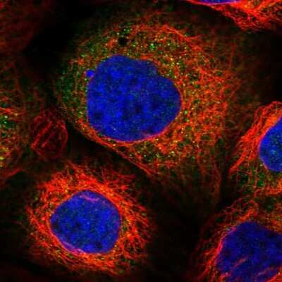 Immunocytochemistry/Immunofluorescence: PPP2R2B Antibody [NBP2-46667] - Staining of human cell line A-431 shows localization to cytosol. Antibody staining is shown in green.