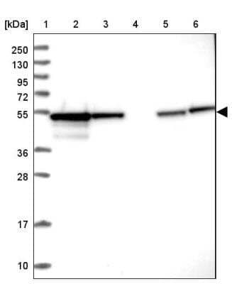 Western Blot: PPP2R2B Antibody [NBP2-46667] - Lane 1: Marker  [kDa] 250, 130, 95, 72, 55, 36, 28, 17, 10, Lane 2: Human cell line RT-4, Lane 3: Human cell line U-251 MG, Lane 4: Human plasma, Lane 5: Human Liver tissue, Lane 6: Human Tonsil tissue.