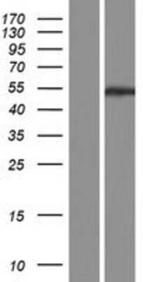 Western Blot PPP2R2C Overexpression Lysate
