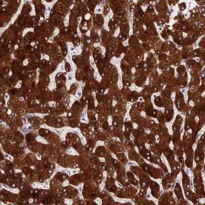 Immunohistochemistry-Paraffin PPP2R2D Antibody - BSA Free