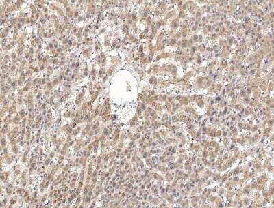 Immunohistochemistry-Paraffin: PPP2R2D Antibody [NBP3-12548] - Staining of human PPP2R2D in human liver with rabbit polyclonal antibody at 1:100 dilution.