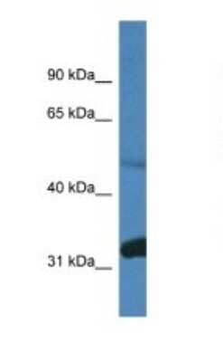Western Blot: PPP2R2D Antibody [NBP1-74170] - Titration: 1.0 ug/ml Positive Control: Mouse Brain.